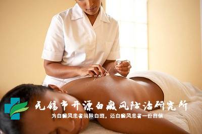 白癜风如何做到对症治疗