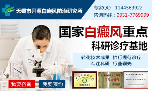 无锡医院可以治疗白癜风吗