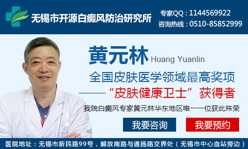 无锡哪家医院值白斑病最好