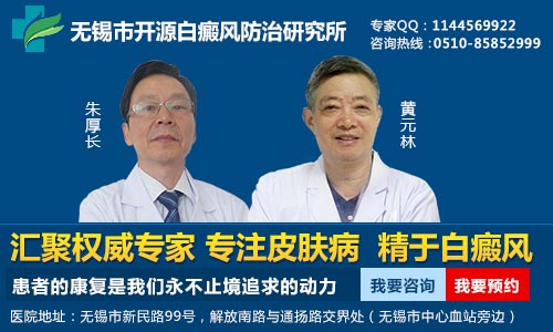 无锡治疗白癜风去哪里