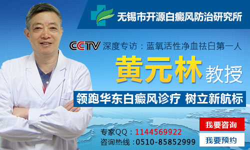 无锡治疗白癜风去哪家医院好