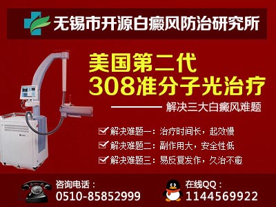 无锡白癜风那里治