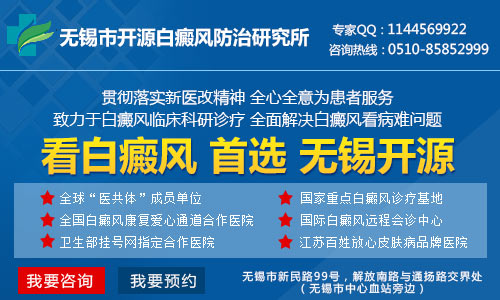 无锡专治白癜风哪家医院好