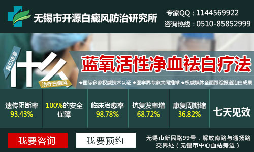 无锡市那家医院治疗白癜风最好