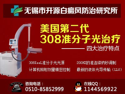 无锡治疗白癫疯的医院在哪里